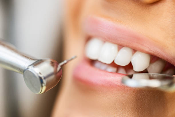 dental cleanings for sensitive teeth what to know